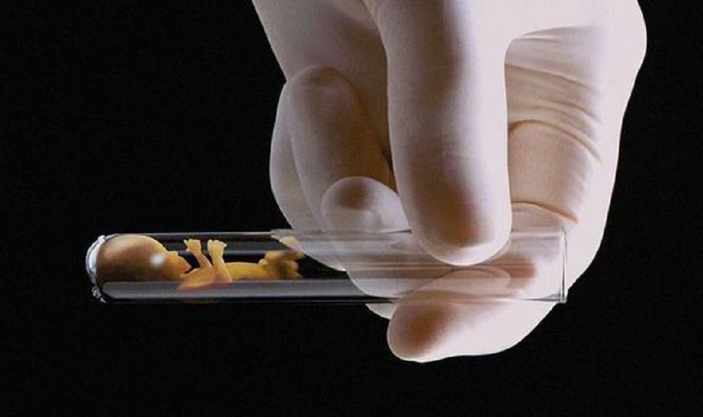 Esepsiz donorlyqtyń erteńi alańdatady