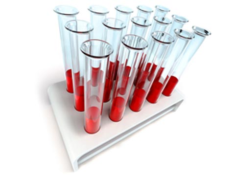 Qazaq­stan­da «gemofılııa» dıagnozy bar 1273 naýqas esepte tur