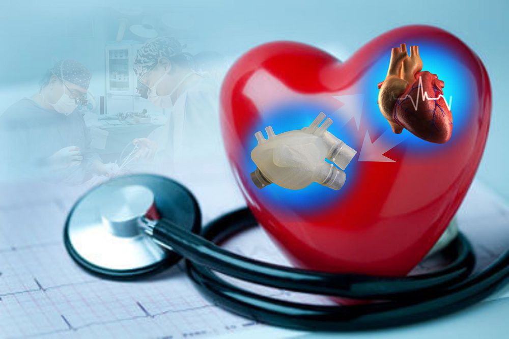 Ulttyq kardıohırýrgııa mamandary júrek aýystyrý jóninen álem nazaryn aýdarǵan biregeı operasııa jasady