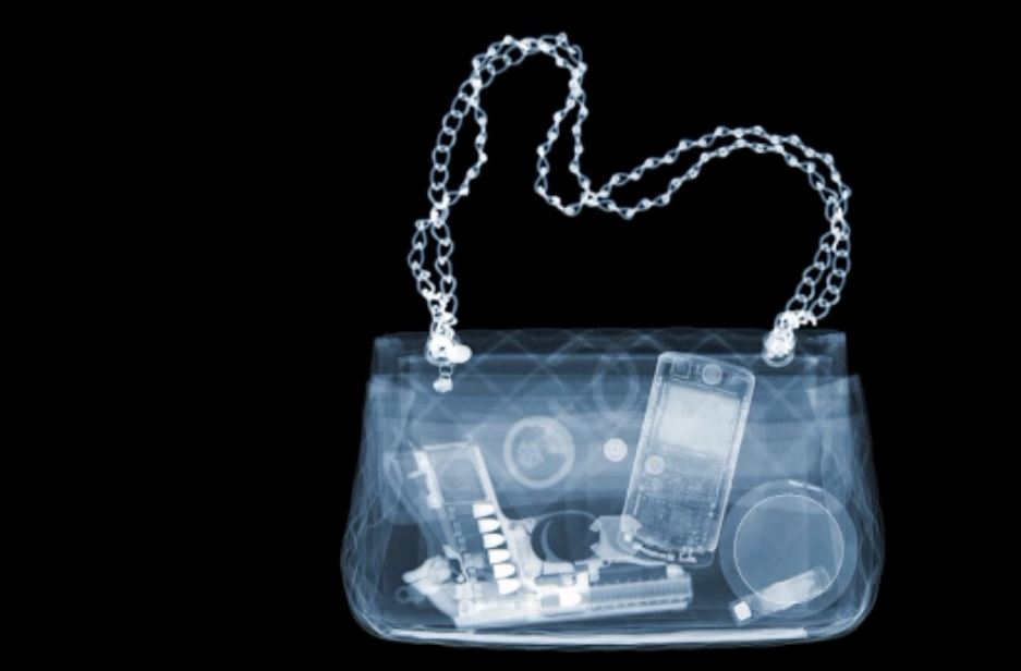 Rentgen kómegimen jasalǵan fotosýretter kórmesi ashyldy