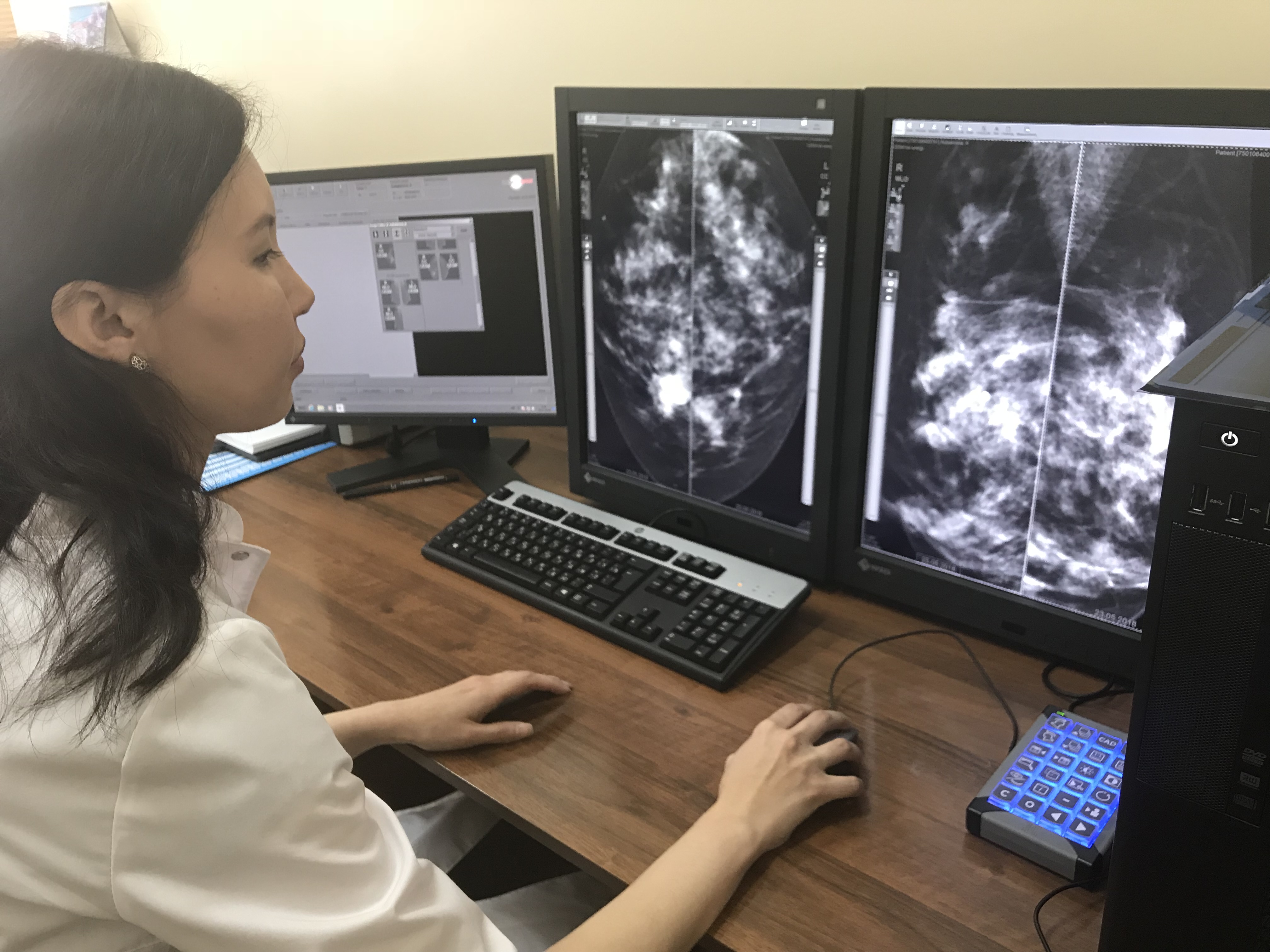 Úkimettiń onkologııalyq aýrýlardyń aldyn alý jónindegi Keshendi jospary júzege asyp otyr ma?