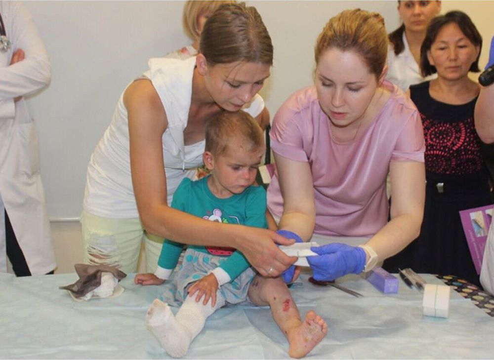 «Kóbelek aýrýy» deıtin kesel bar