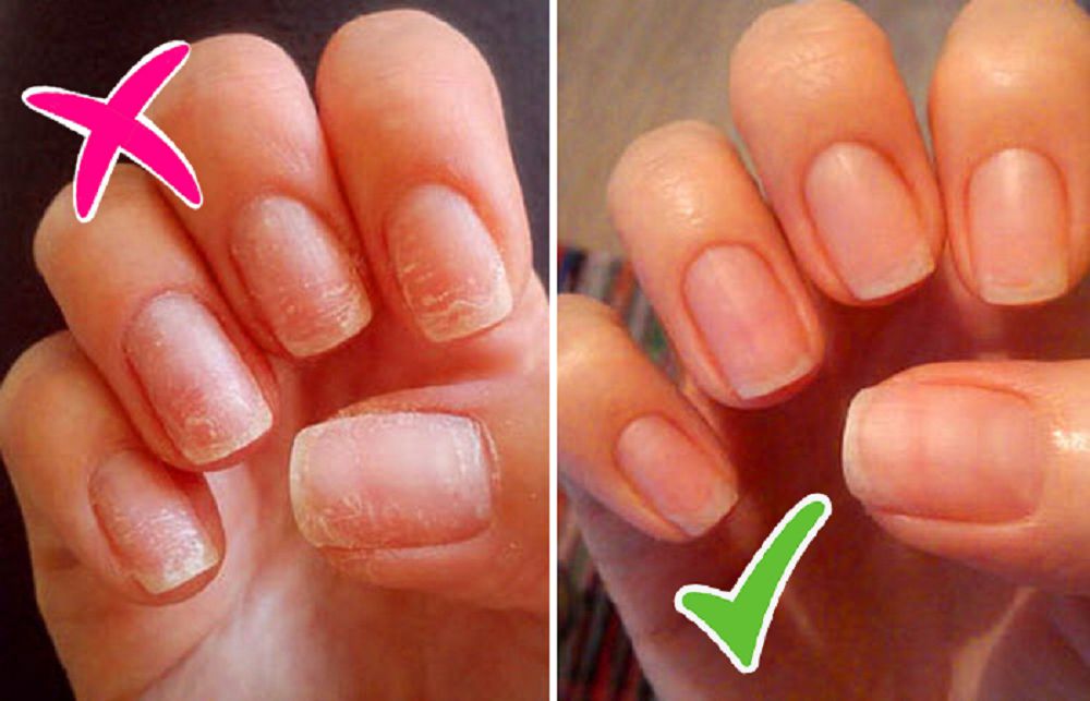 Gel-laktyń qorqynyshty qateri