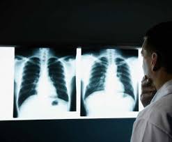 Flıýorografııalyq tekserýden ótý mańyzdy