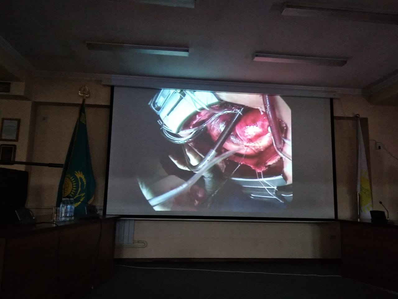 Otandyq dárigerlerimiz alǵash ret nemis kardıologtarymen birge otanyń jańa túrin jasady