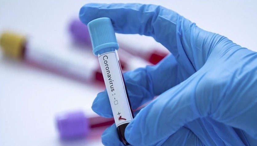 Elimizde vırýs juqtyrǵandar sany 59-ǵa jetti