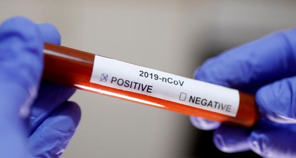 Pandemııanyń aýyr sheńgeli elimizdiń batys óńirine de aýyz sala bastady