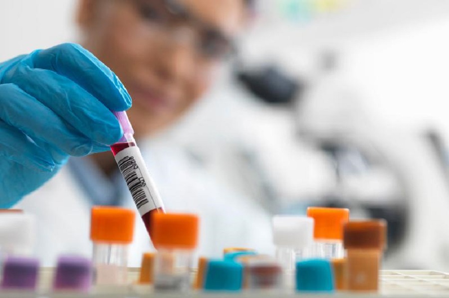 100 jylda bir ret Jerge úlken aýrý keledi. Sáıkestik pe?