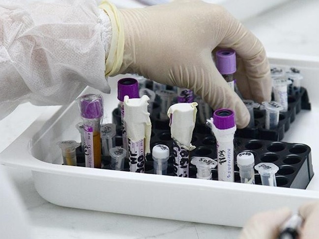 SQO: Koronavırýs juqtyrǵan qyzdyń jaǵdaıy birqalypty