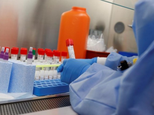 Túrkistan oblysy: Koronavırýs juqtyrǵan adammen birge kelgen 10 jolaýshy izdestirilip jatyr