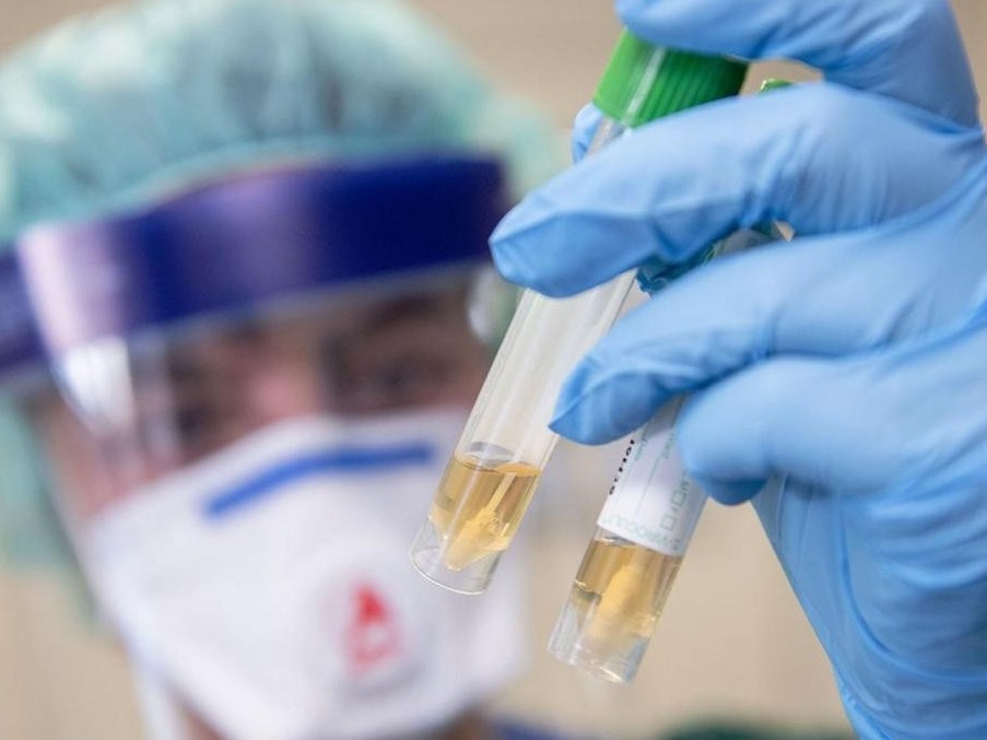 COVID-19: Vırýstyq genosıd jəne indettiń əlemdik demografııaǵa əseri