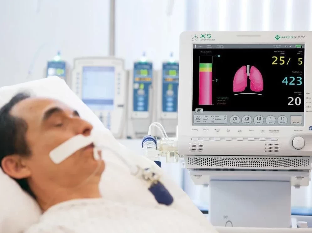 «Qazaqstan ınjınırıng» ókpeni jasandy jeldetýge arnalǵan 180 apparat jınaǵyn tegin berýge ázir