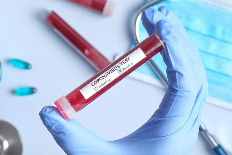 Qyzylorda: Taǵy úsh adamnan ınfeksııa anyqtaldy