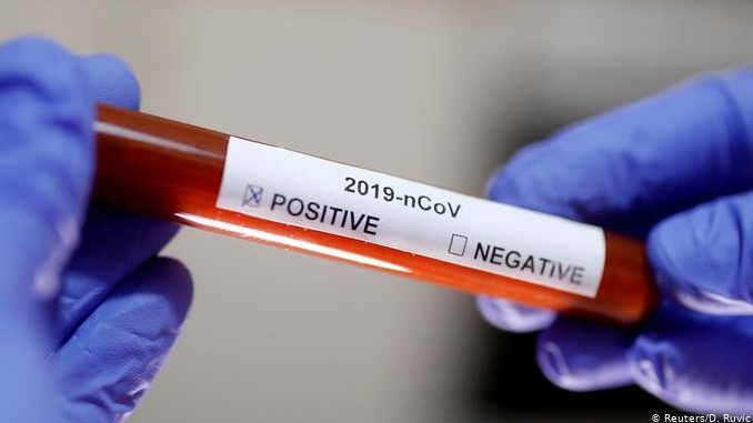 Atyraýda 700-ge jýyq ekspress-test bar