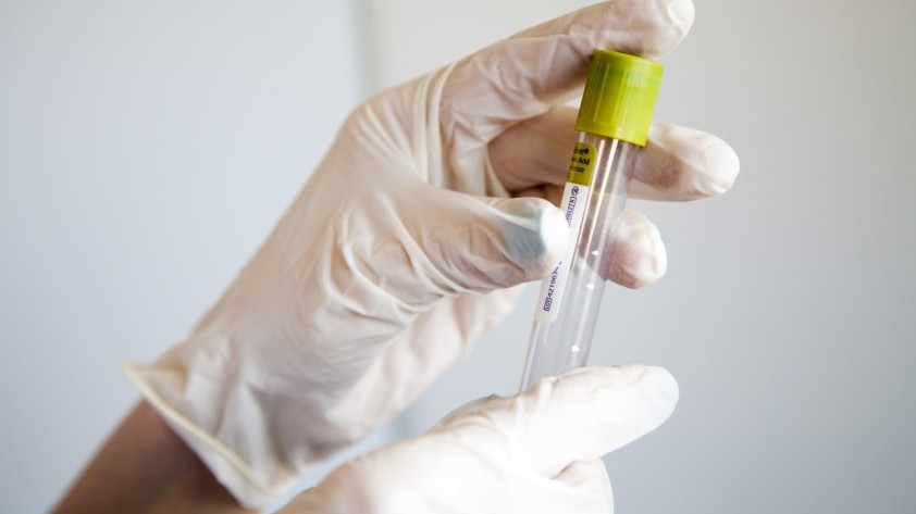 Qyzylorda: Naýqastardyń jaǵdaıy qalypty