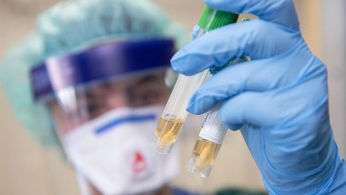 Qaraǵandyda 6 stýdentten koronavırýs belgisi tabyldy