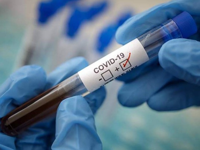 Shymkentte taǵy bir azamat koronavırýs juqtyrǵan