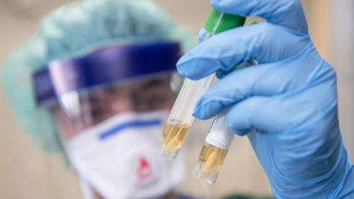 Qyzylorda oblysynda COVID-19 ınfeksııasyn juqtyrǵan 11 jaǵdaı týraly aqparat