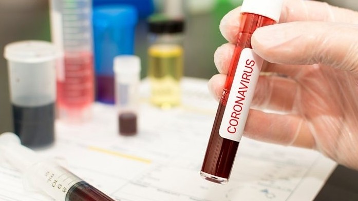 Jetisýda koronavırýspen aýyrǵan naýqas sany on ekige jetti