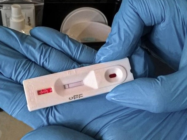 Almatyda koronavırýs juqtyrǵan dárigerlerge baılanysty epıdemıologııalyq tergeý bastaldy