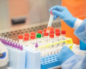 Koronavırýs ınfeksııasyn juqtyrǵan taǵy 8 adam tirkeldi