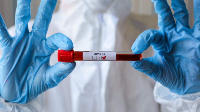 Jambyl: vırýs juqtyrǵan azamat Atyraýda vahtalyq negizde jumys isteıdi