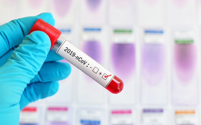 Qazaqstanda koronavırýs juqtyrǵandar sany 2660 adamǵa jetti