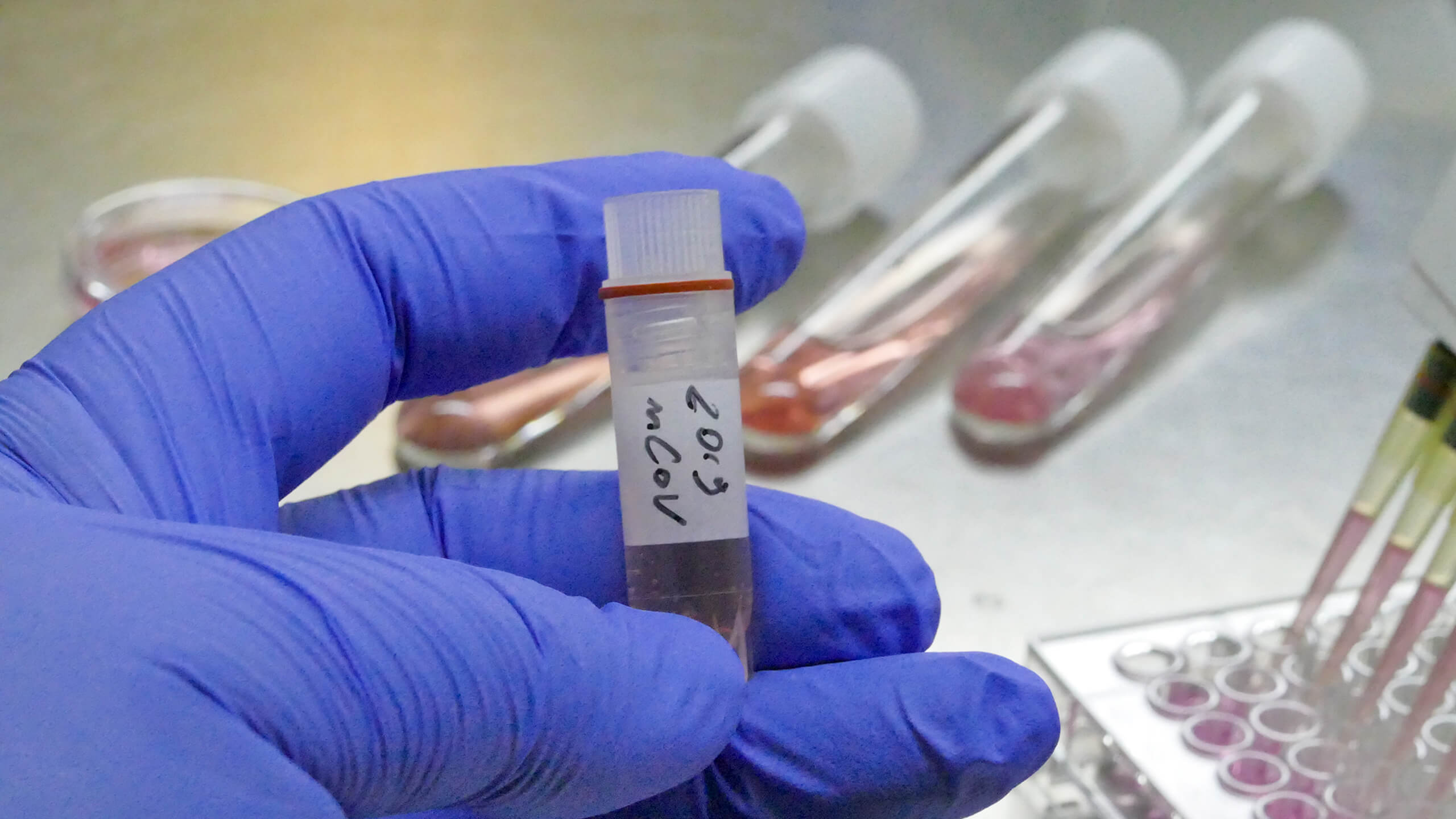 Vırýs juqtyrǵan Pavlodar qalasynyń turǵyny 55 jasta