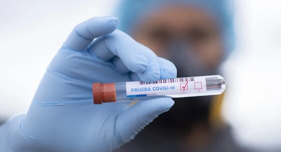 2791 naýqas: Koronavırýs ınfeksııasyn juqtyrǵan taǵy 11 adam tirkeldi