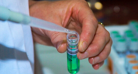 Almaty qalasynda koronavırýs juqtyrǵandar sany bir adamǵa artyq kórsetilgen