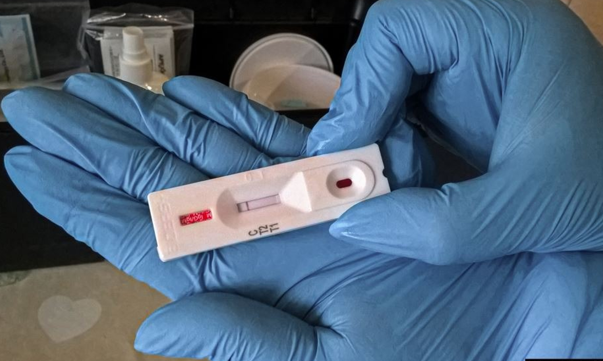 Qaraǵandy oblysynda koronavırýs juqtyrǵan 2 naýqas tirkeldi