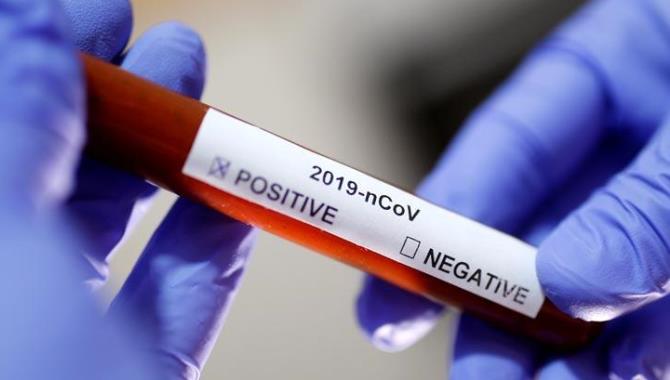 Batys Qazaqstanda ótken táýlikte 40 adam vırýs juqtyrǵan