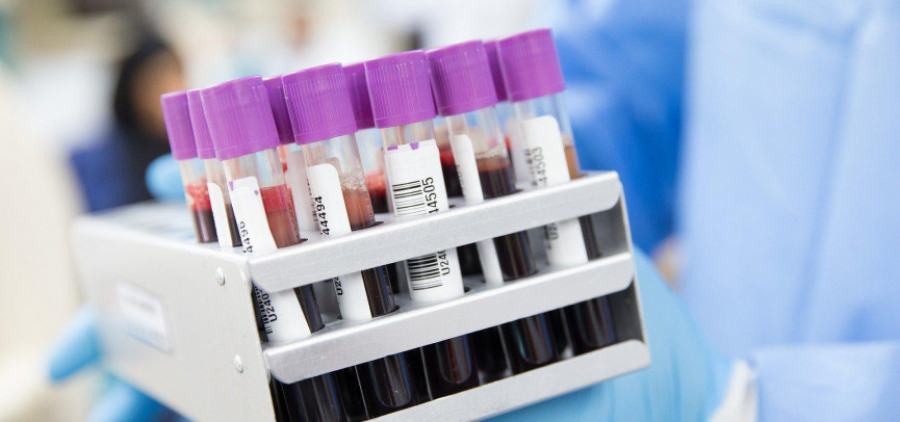 Qarjy sektory koronavırýstyq daǵdarysqa daıyn boldy