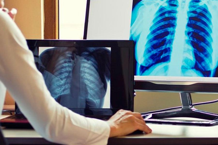 О́kpesi qabynǵan naýqas sany ósti