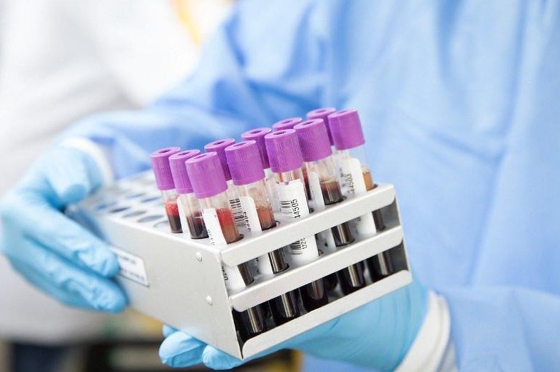 COVID-19: Test qaı kezde durys kórsetpeıdi?