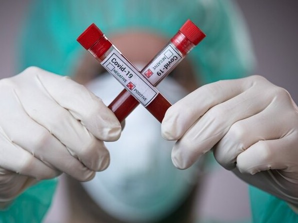 Koronavırýsty jyldam anyqtaıtyn qurylǵy oılap tabyldy