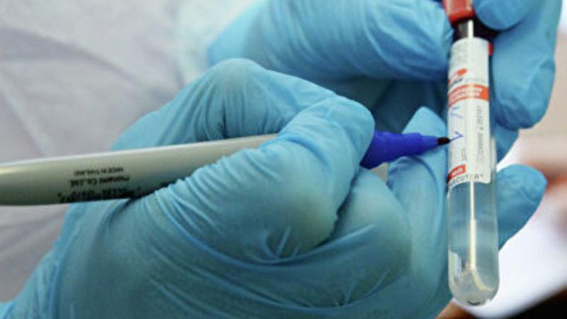 Onkologııalyq naýqastar arasynda 168 adam vırýs juqtyrǵan