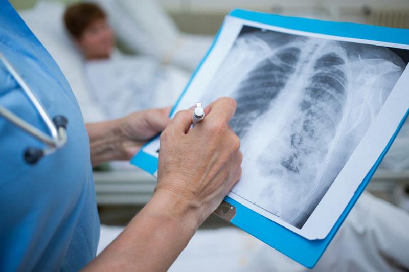 COVID-19: Qalypty tirlik qalǵaly qashan