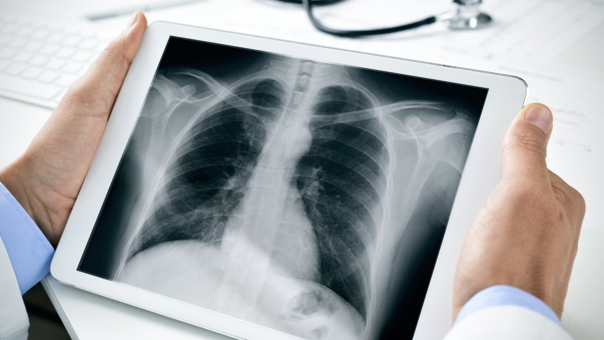 Koronavırýstan keıin aǵzany qalaı qalpyna keltirýge bolady?