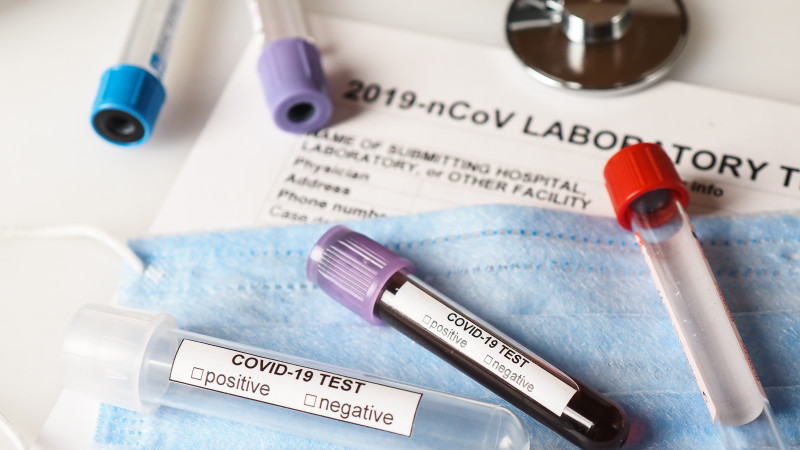 Atyraýda taǵy da 12 adam qaýipti indetke shaldyqty