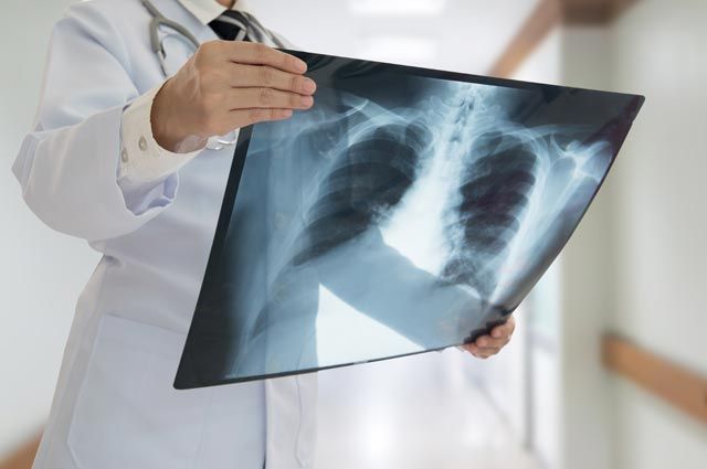 Koronavırýs juqtyrǵan 119 adamnyń jaǵdaıy nashar