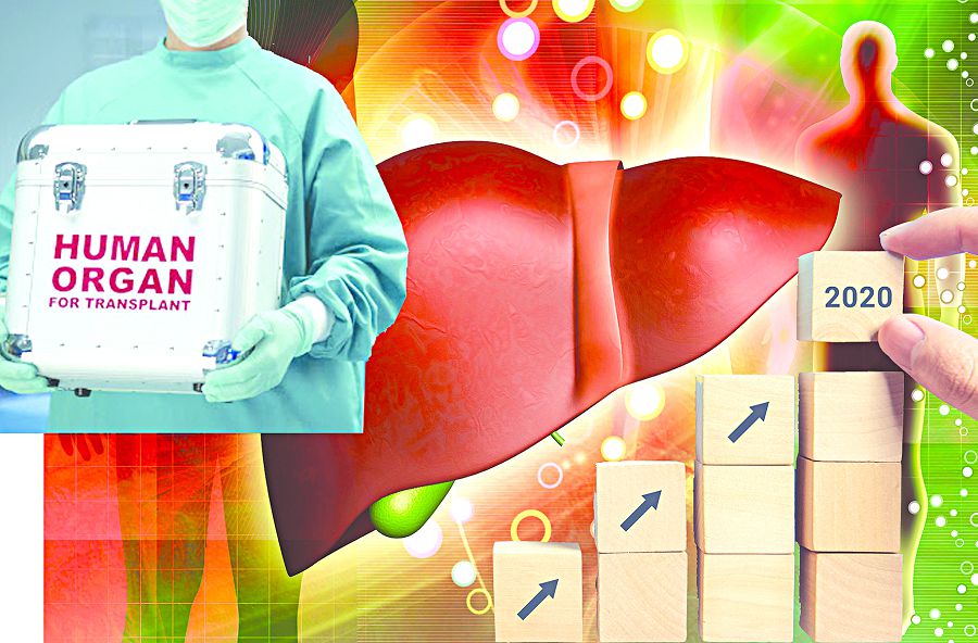 Transplantologııa túıtkili (Aǵza donorlyǵyna muqtajdar qatary artýda)