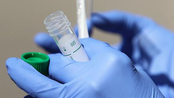 Bir táýlikte koronavırýs pen pnevmonııadan 13 adam qaıtys boldy