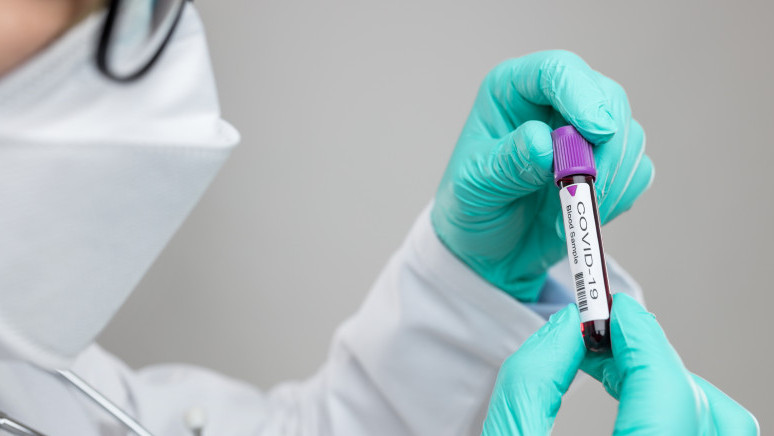 Atyraý oblysynda úsh táýlikte 344 adam koronavırýsqa shaldyqty