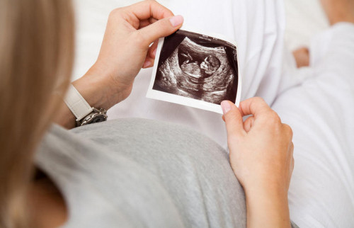 Atyraýlyq áıel júktiligin dárigerden jasyryp kelgen