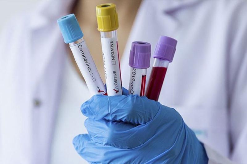 Koronavırýs: Almatyda bir táýlikte 293 naýqas anyqtaldy