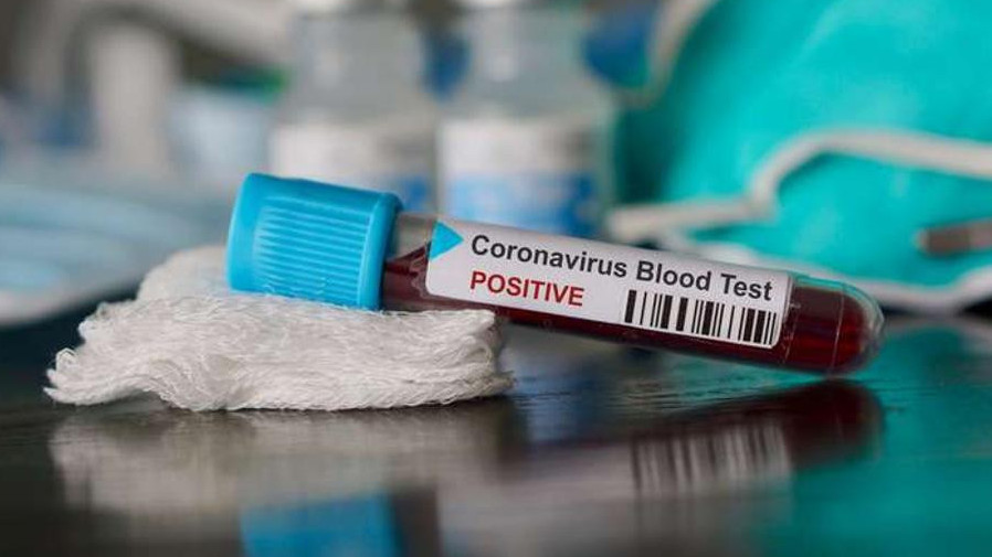 Atyraýda koronavırýsqa shaldyqqandar sany 48 adamǵa kóbeıdi