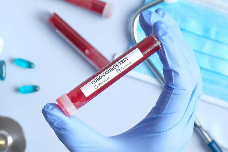 Mańǵystaý oblysynda 12 oqýshy jáne 4 muǵalim koronavırýs juqtyrdy