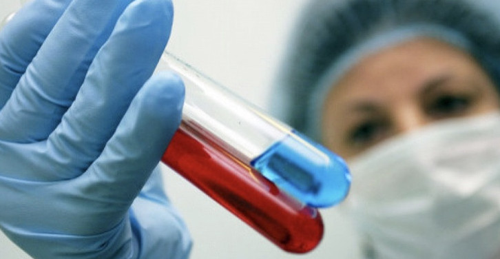 Almatyda AITV-ny toqtatýdyń jańa ádisi engizildi