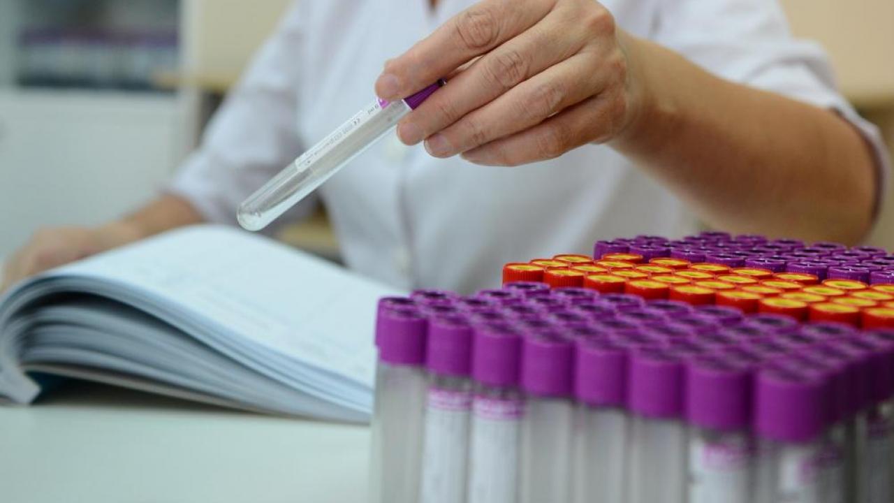 Atyraýda barlyǵy 1,2 mln PTR-test ótkizilgen